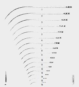 Голки хірургічні, з пружинним вушком діаметром 0,7 мм (mm), ріжуча, напівзігнуті, довжиною 22,0 мм (mm)